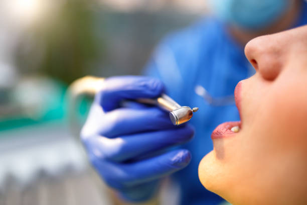 Oral Cancer Screening in Patterson Tract, CA